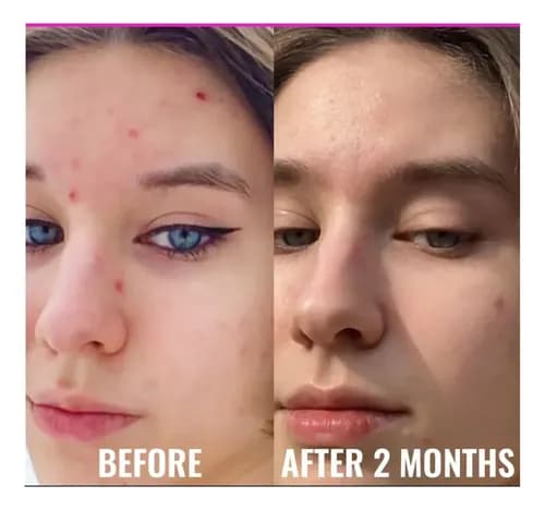 Good Molecules Niacinamide Serum 30 ml 7
