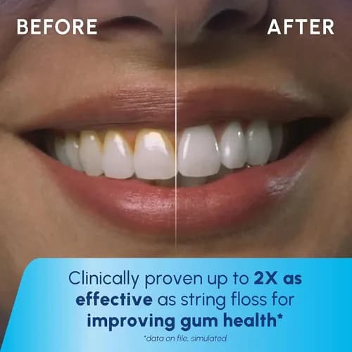 Waterpik Cordless Pulse 3100 Oral Irrigator 3