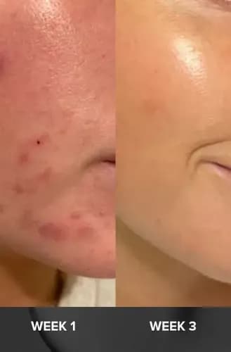 Paula's Choice Skin Perfecting 2% BHA Liquid Exfoliant 118 ml 7