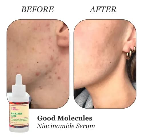 Good Molecules Niacinamide Serum 30 ml 6
