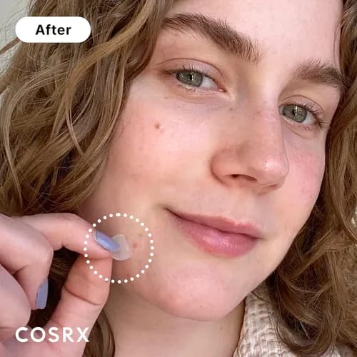 COSRX Acne Pimple Master Patch 48 parches 4
